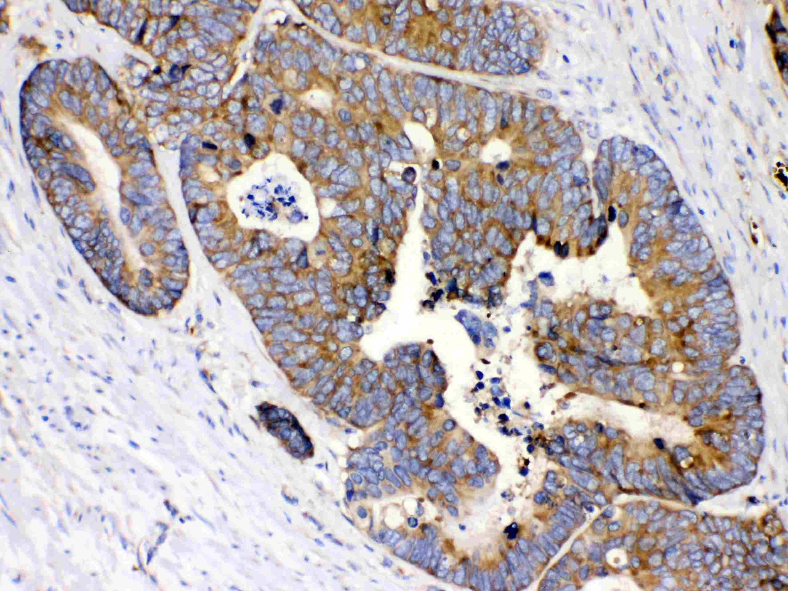 Polyclonal Rabbit anti-Human RPS27 / Ribosomal Protein S27 Antibody (IHC, WB)