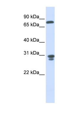 Polyclonal Rabbit anti-Human NIT2 Antibody (aa72-121, IHC, WB)