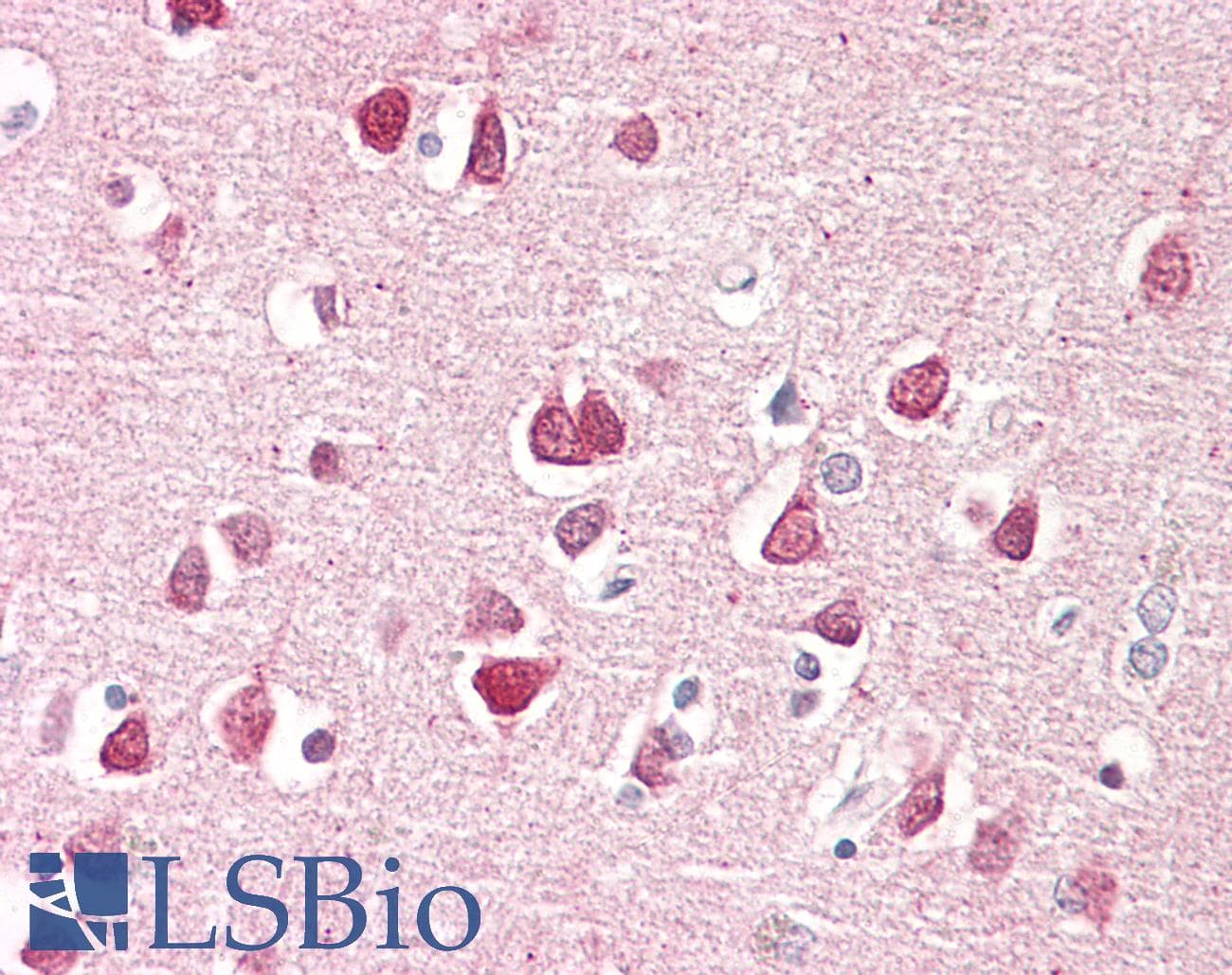 IHC-plus™ Polyclonal Rabbit anti-Human KCNJ11 / Kir6.2 Antibody (aa190-239, IHC, IF, WB)