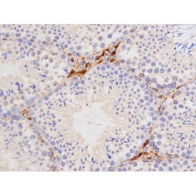 Polyclonal Rabbit anti-Human MAPT / Tau Antibody (phospho-Thr212, IHC, WB)