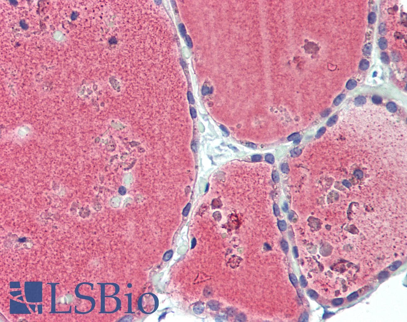 IHC-plus™ Polyclonal Rabbit anti-Human INHBB / Inhibin Beta B Antibody (aa369-397, IHC, WB)