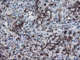 UNG / Uracil DNA Glycosylase Antibody (clone OTI2F8)
