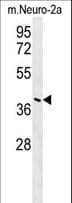 IHC-plus™ CASC4 Antibody (aa336-365)
