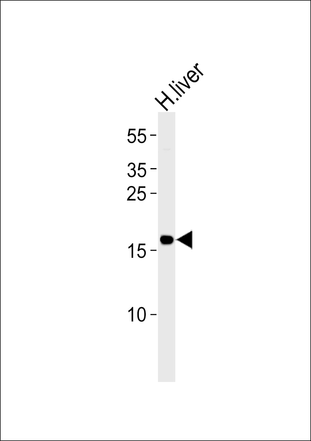GLRX5 / Glutaredoxin 5 Antibody (aa93-127)