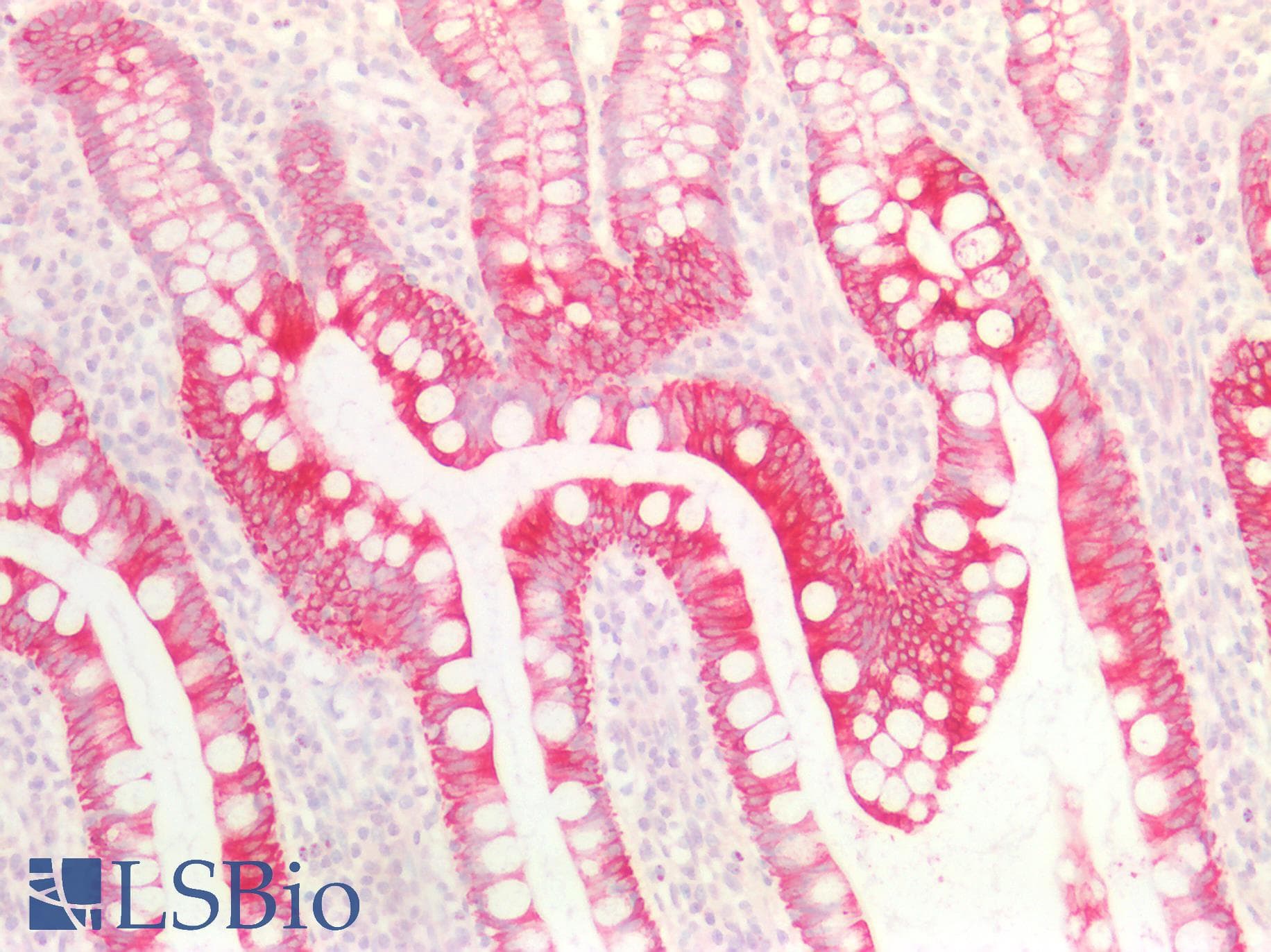 IHC-plus™ Monoclonal Mouse anti-Human KRT18 / CK18 / Cytokeratin 18 Antibody (IHC, WB)