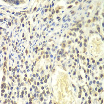 Polyclonal Rabbit anti-Human PSMA4 Antibody (IHC, IF, WB)