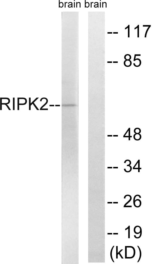 RICK / RIP2 Antibody (aa146-195)