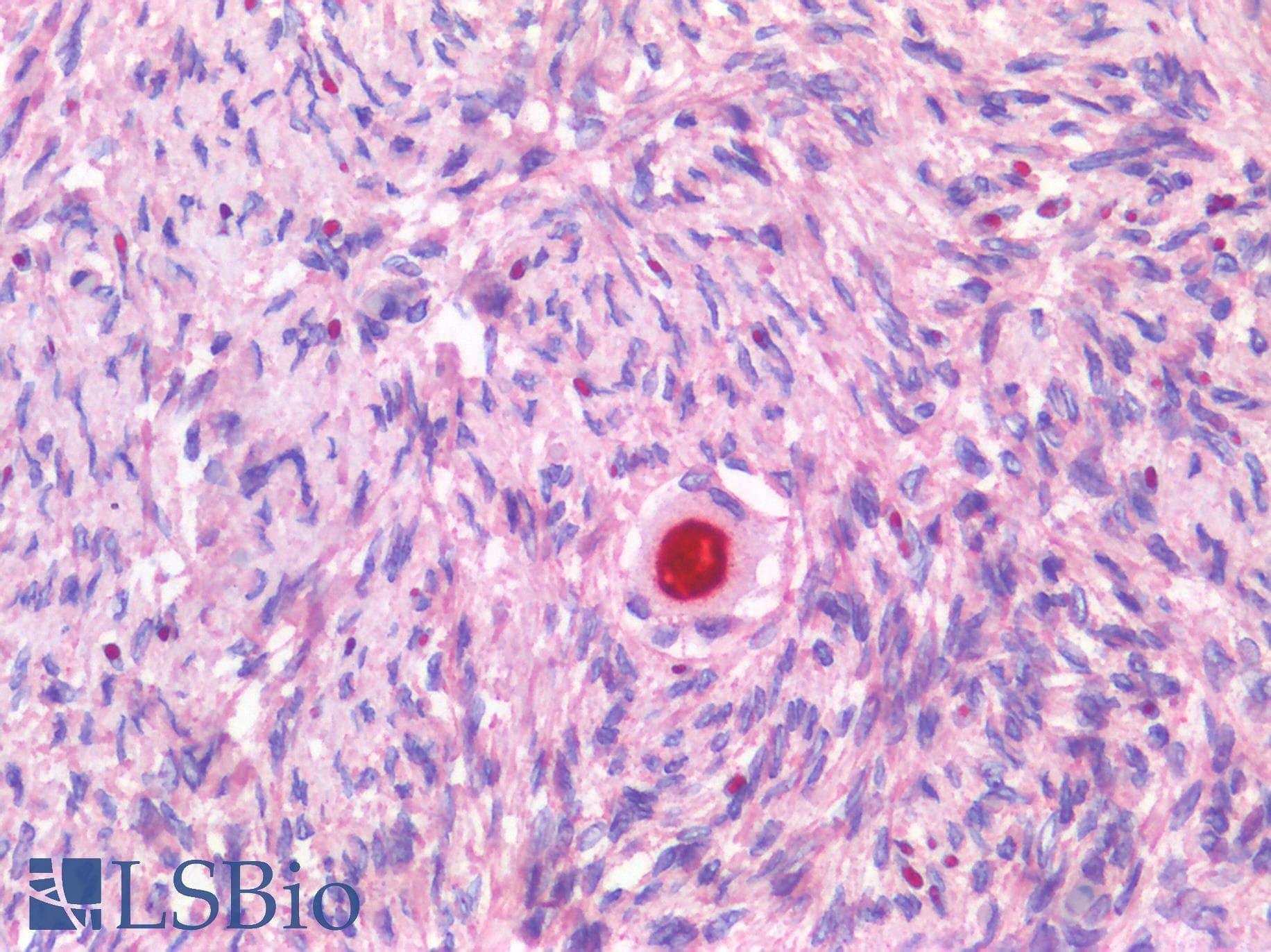 PathPlus™ NR5A1 / SF1 Antibody (Internal)
