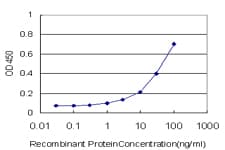 IHC-plus™ Monoclonal Mouse anti-Human RPS7 / Ribosomal Protein S7 Antibody (clone 3G4, IHC, IF, WB)