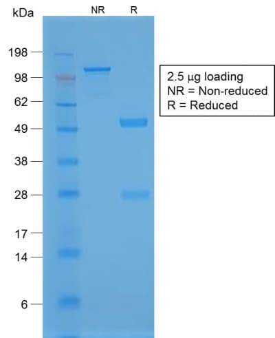 Recombinant Monoclonal Rabbit anti-Human NKX2-1 / Thyroid-Specific TF Antibody (clone NX2.1/1855R, IHC)