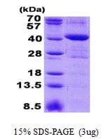 Human MRM1 Protein (Recombinant His)