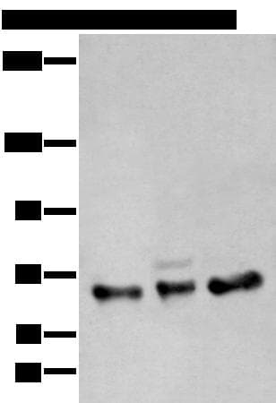 ZBTB5 Antibody