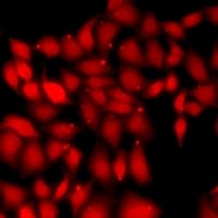 DDX20 / GEMIN3 Antibody