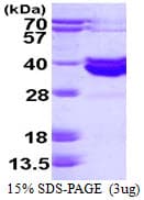 Human ABO Glycosyltransferase Protein (Recombinant His)