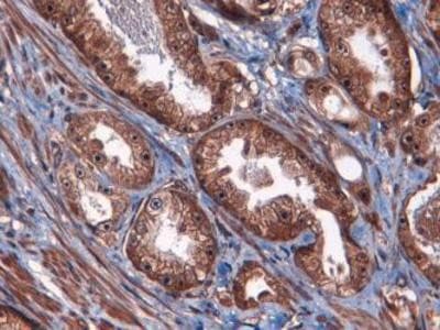 ATF3 Antibody (Biotin)