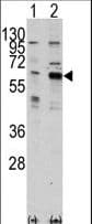 Polyclonal Rabbit anti-Human PAK3 Antibody (aa218-247, IHC, WB)