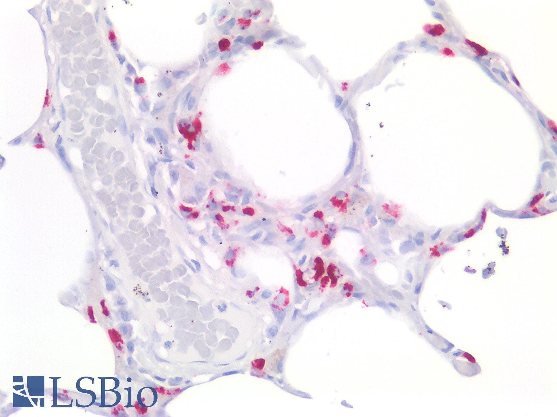 LAMP3 / CD208 Antibody (aa222-381)