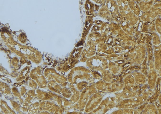 STX11 / Syntaxin 11 Antibody