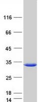 Human RILPL2 Protein (Recombinant Myc-DDK (Flag))