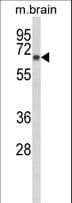 IHC-plus™ DAB1 Antibody (aa189-216)