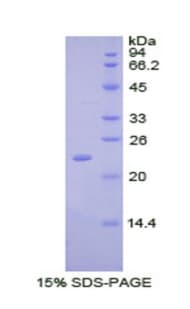 Chicken SPTAN1 / Alpha Fodrin Protein (Recombinant His)