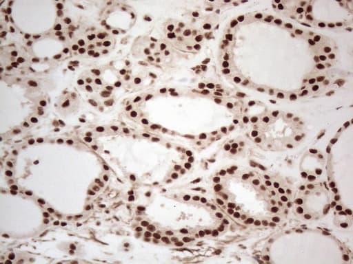 IRS1 Antibody (aa1-280, clone OTI3G10, Carrier-free)