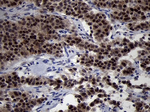 OIP5 Antibody (clone OTI1D12)