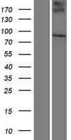 SMPD4 Protein (Over-Expression Lysate Myc-DDK (Flag))