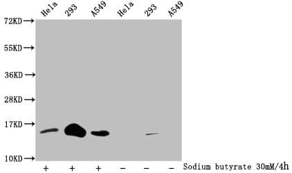 Polyclonal Rabbit anti-Human HIST1H2BN Antibody (WB)