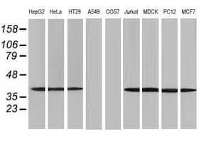 ACAT2 Antibody (clone OTI7B1)
