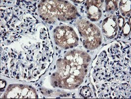 MAP2K1 / MKK1 / MEK1 Antibody (clone OTI1A10)
