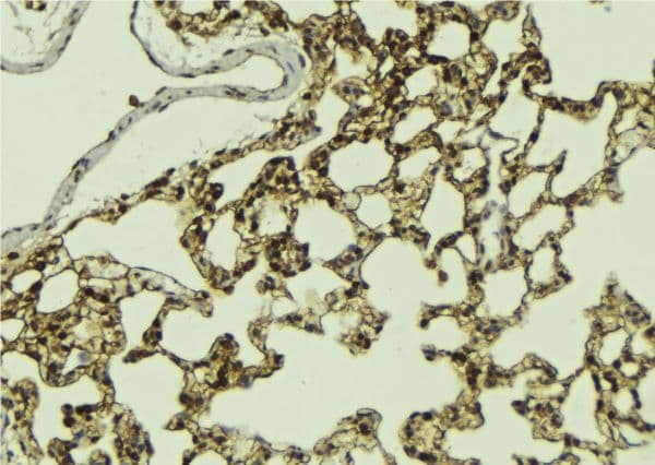 ATRIP Antibody (phospho-Ser224)