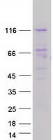 Human DGK-IOTA / DGKI Protein (Recombinant Myc-DDK (Flag))