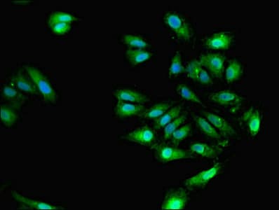 IHC-plus™ Polyclonal Rabbit anti-Human ELAVL4 / HuD Antibody (IHC, IF, WB)