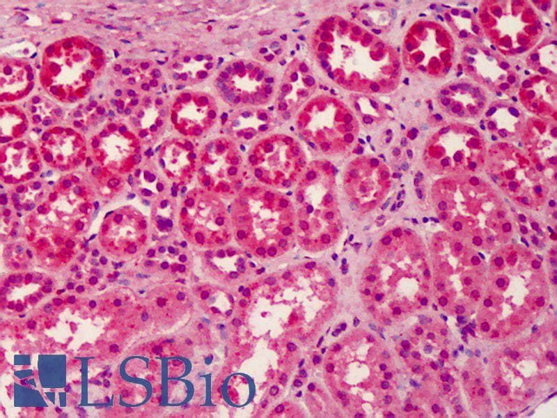IHC-plus™ Polyclonal Rabbit anti-Human LGI3 Antibody (IHC, WB)