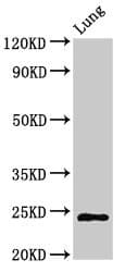 CHMP6 Antibody