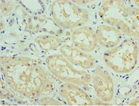 Polyclonal Rabbit anti-Human SOST / Sclerostin Antibody (aa24-213, IHC)