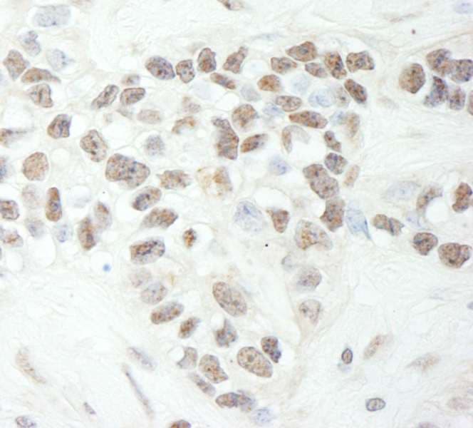 Polyclonal Rabbit anti-Human MED12 Antibody (aa2150-C-term, IHC, WB)