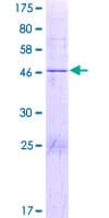 Human JOSD1 Protein (Recombinant GST)
