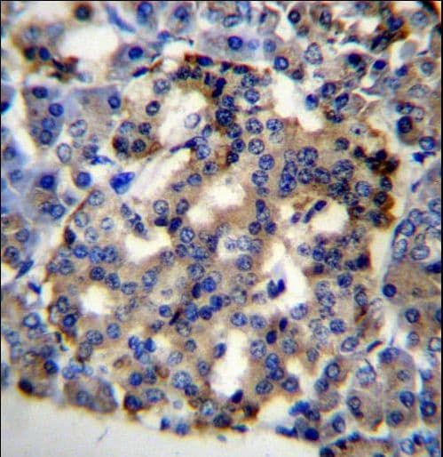 C10orf2 / PEO1 Antibody (aa656-684)