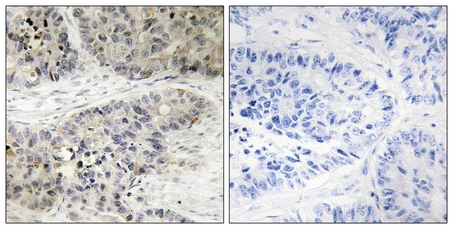 MAPK15 / ERK7 Antibody