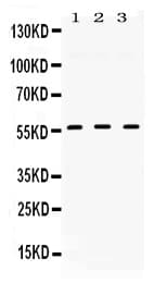 TGFBR1 / ALK5 Antibody