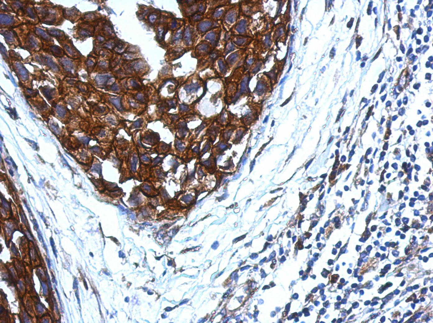 KIR2DS4 Antibody