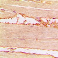 NF2 / Merlin Antibody (phospho-Ser518)