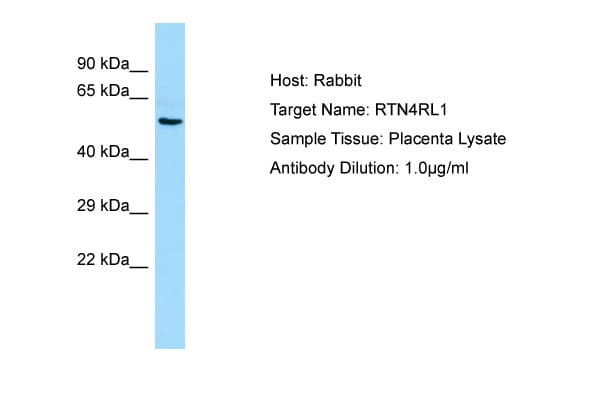 RTN4RL1 / NGRH2 Antibody (aa331-380)
