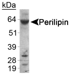 PLIN1 / Perilipin Antibody (C-Terminus, DY488)