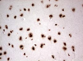 Monoclonal Mouse anti-Human NUMB Antibody (clone OTI2E8, aa1-365, IHC, WB)