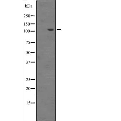 INTS6 Antibody