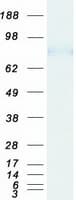 Human RIP1 / RALBP1 Protein (Recombinant Myc-DDK (Flag))