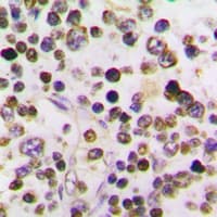 CCNA1 / Cyclin A1 Antibody (C-Terminus)